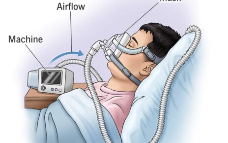 CPAP Device Market