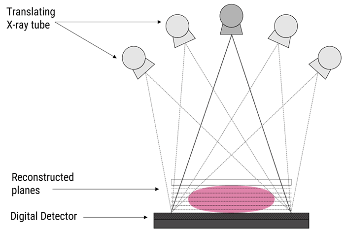 Digital Breast Tomosynthesis