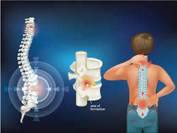 Spinal Cord Injury Market