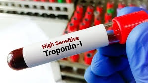 Troponin Market